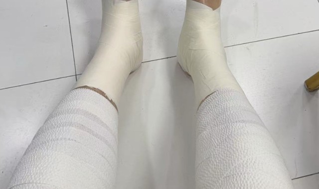 星空体育官网-胜山西谁注意翟晓川赛后伤势？双腿拉伤绑满绷带，看着都残忍！